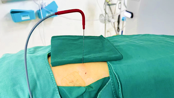 定西想预防肝癌就吃这6种食物