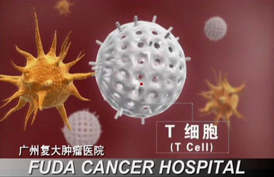 联合免疫疗法(CIC)