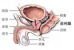 大理阴囊肿瘤