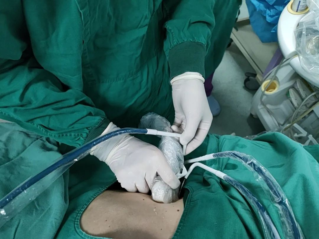 胰腺癌治疗