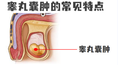济源阴囊肿瘤怎么治疗