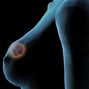 中医可以治疗乳腺癌吗？