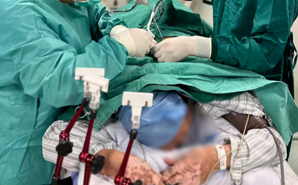 骨癌明显的征兆,骨癌典型的一个症状