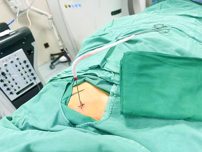 梅州胃癌症状,梅州胃癌原因,梅州胃癌